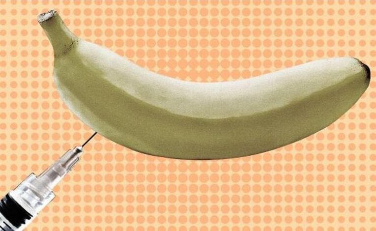 iniksyon na pagpapalaki ng ari gamit ang isang saging bilang isang halimbawa
